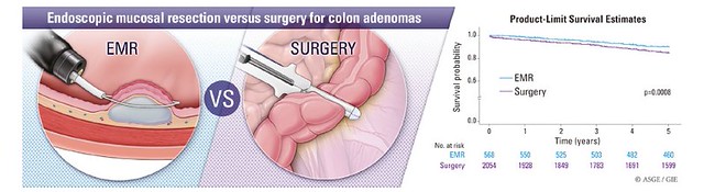 EMR versus surgery for colon adenomas and early-stage cancers: a ...