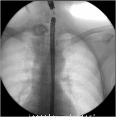 Zacharias_Philip_figure