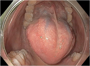 Yadav_Huelsen_figure