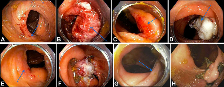 Bowler_Karna_Bilal_figure