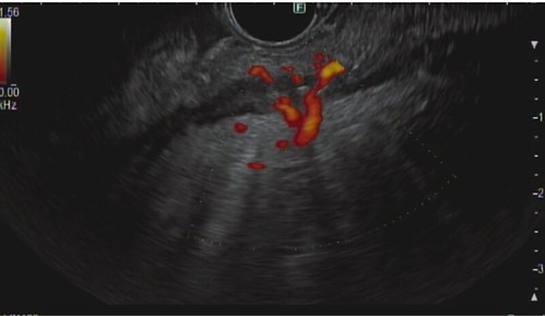 Maniak_Waxman_figure