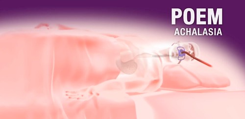 Solinski_Aadam_figure