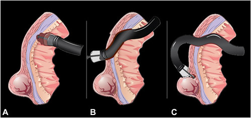 Bapaye_Bhagwat_figure