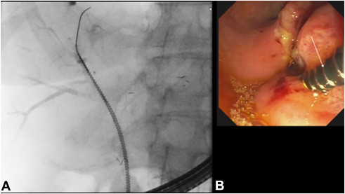Almasri_Karna_Abdalla_Amateau_Freeman_figure