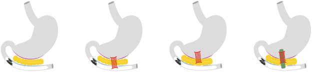 Martins_Mota_Vilas-Boas_figure