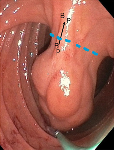 Kumar_figure
